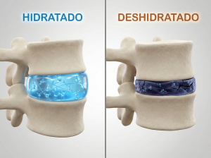 Disco hidratado/no hidratado